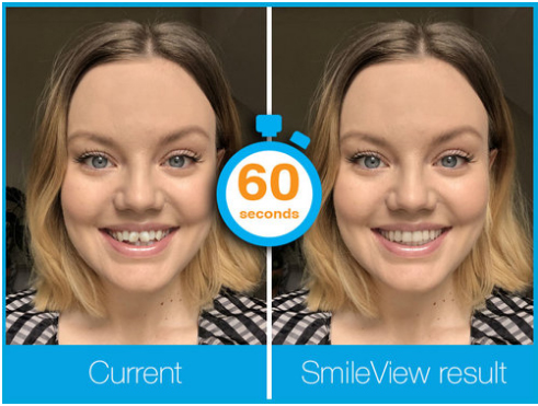 Current Smile and Projected Corrected Smile